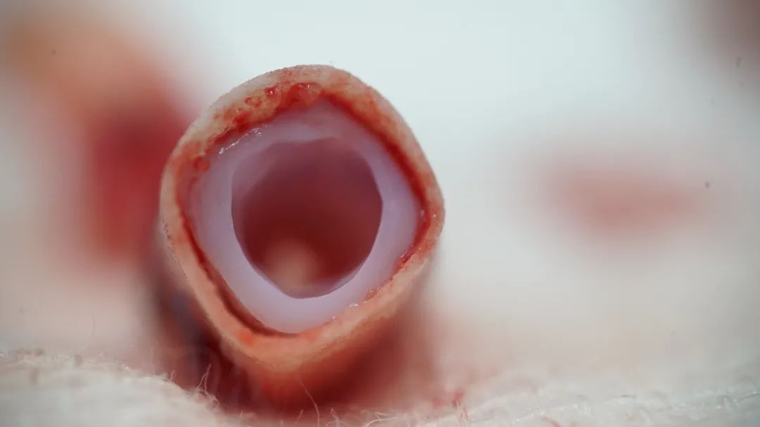 全球首款干細(xì)胞3D生物打印產(chǎn)品獲得國家衛(wèi)生健康委員會的臨床批準(zhǔn)